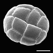 Pollen Grain S.E.M - &lt;em&gt; Acacia berlandieri&lt;/em&gt; - Guajillo