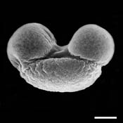 Pollen Grain S.E.M - &lt;em&gt; Pinus echinata&lt;/em&gt; - Shortleaf pine