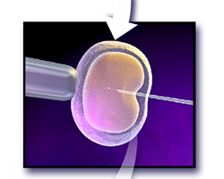 In vitro fertilization