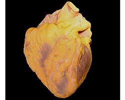 Human heart