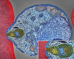 A malaria parasite colorized to look blue, attaching to a red blood cell.