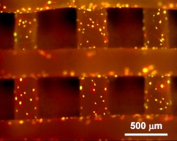 bone cells growing on a scaffold