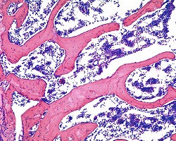 Spongy bone histology slide