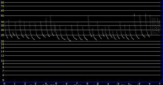 sonogram