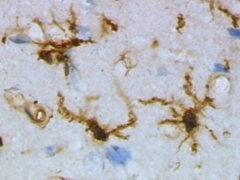 Microglia