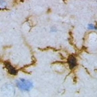 Microglia