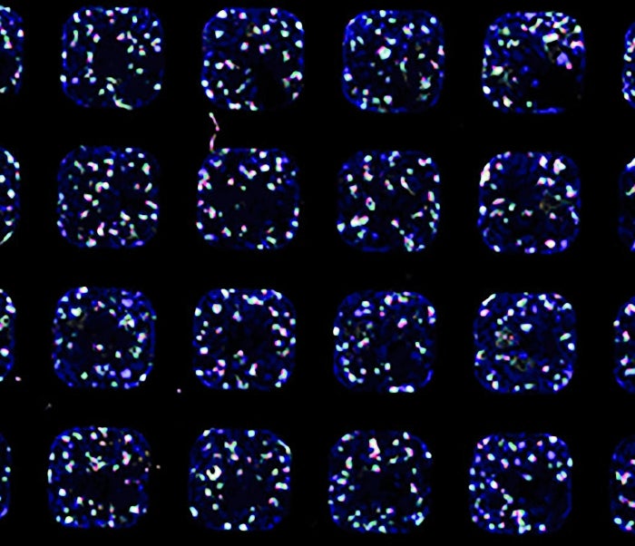 glowing kidney cells grown in a lab