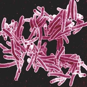 Mycobacterium tuberculosis