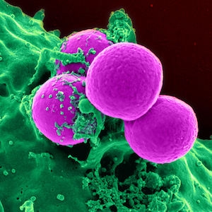 Neutrophil eating MRSA